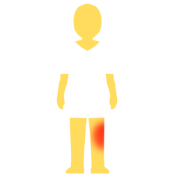 A person with no hair or face, an emoji yellow skintown, and a white pair of shorts and pants with no visible divider between the two. there's a glowing red spot on their right knee.